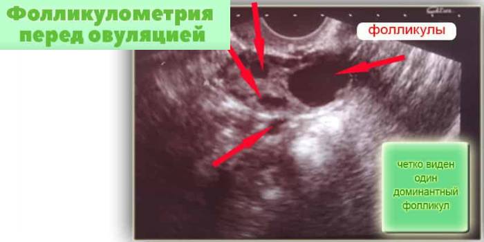 Перед овуляцией
