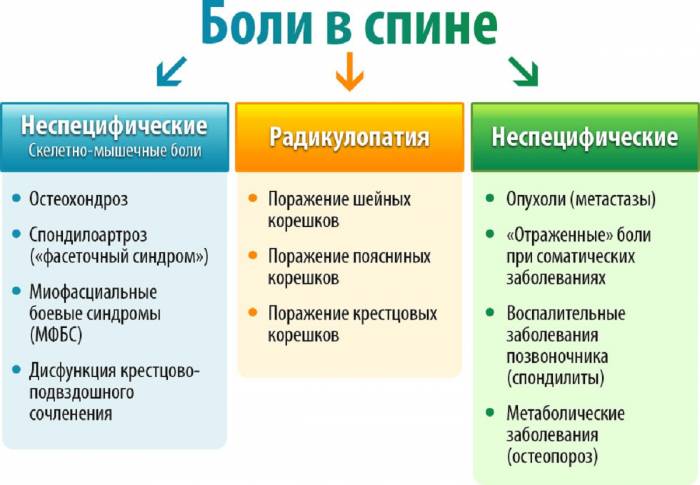 Виды болей в спине