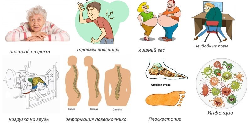 Причины спондилоартроза