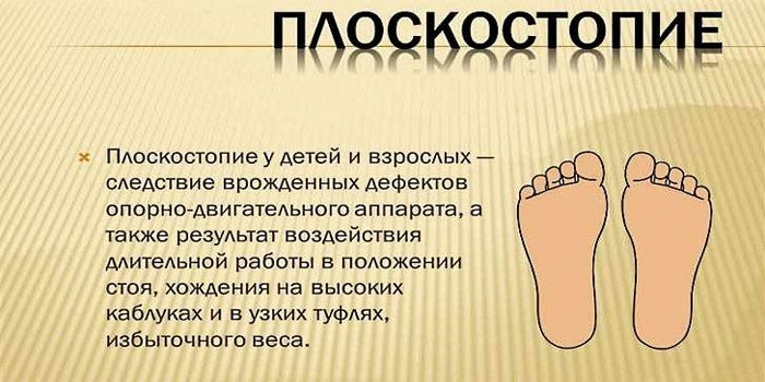 Причины плоскостопия