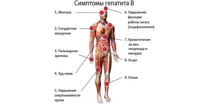 Симптомы гепатита В