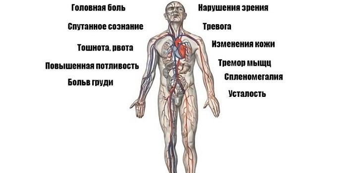 Симптомы гипертонии