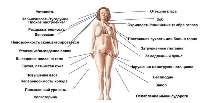 Симптомы гипотиреоза