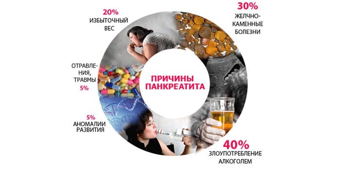 Причины панкреатита