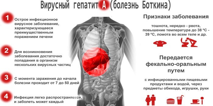 Гепатит А