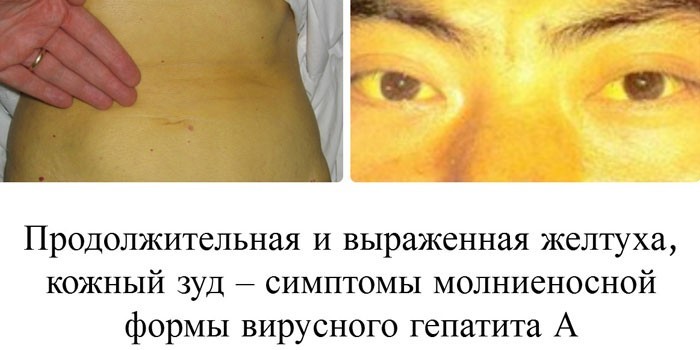 Признаки и проявления