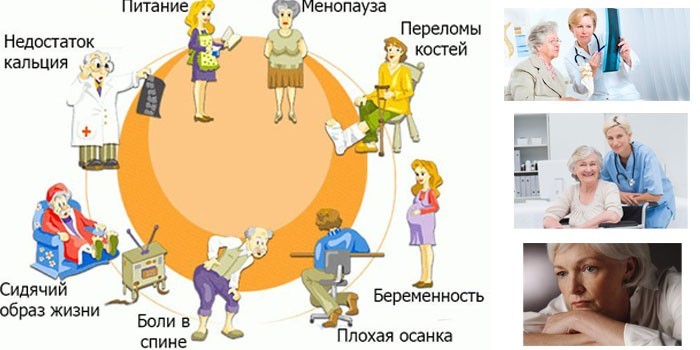 Причины заболевания у женщин