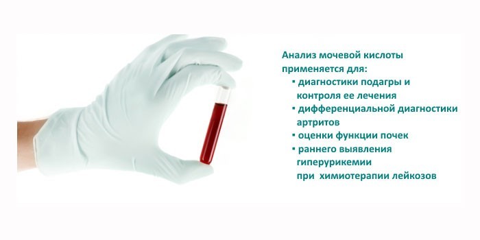 Основания для проведения анализа на мочевую кислоту