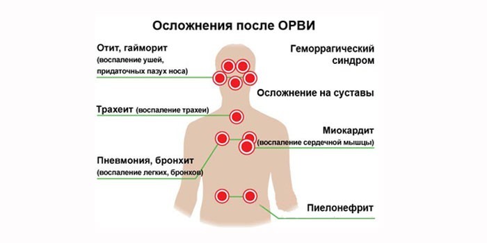 Осложнения после орви