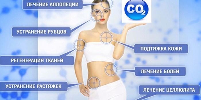 Эффект карбокситерапии