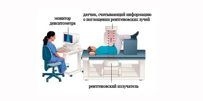Рентгеновская остеоденситометрия