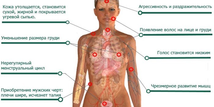 Симптомы повышенного тестостерона у женщин
