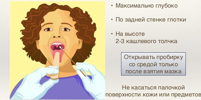 Техника проведения мазка из горла