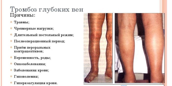 Причины заболевания