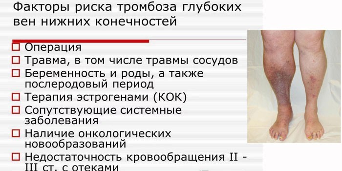 Факторы риска тромбообразования