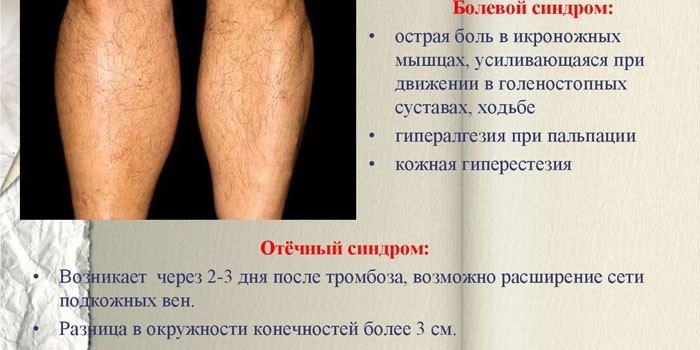 Болевой и отечный синдром