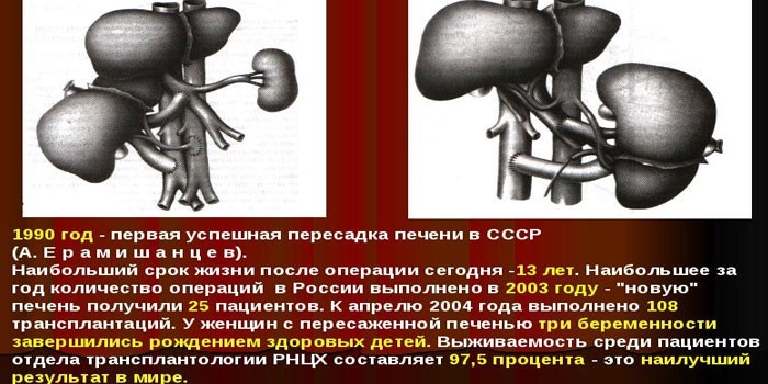 Гетеротопическая методика