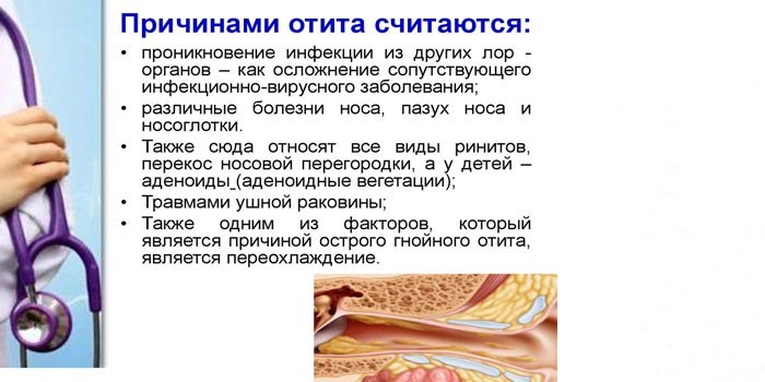 Причины отита