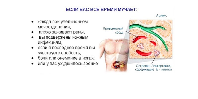 Симптомы повышенного сахара