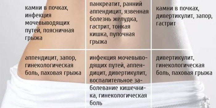 Локализация боли при грыже
