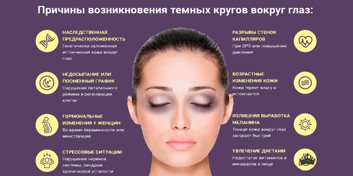 Причины возникновения темных кругов вокруг глаз