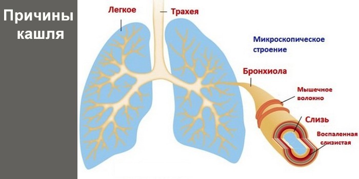 Причины кашля