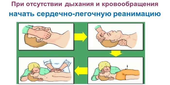 Действия при отсутствии дыхания
