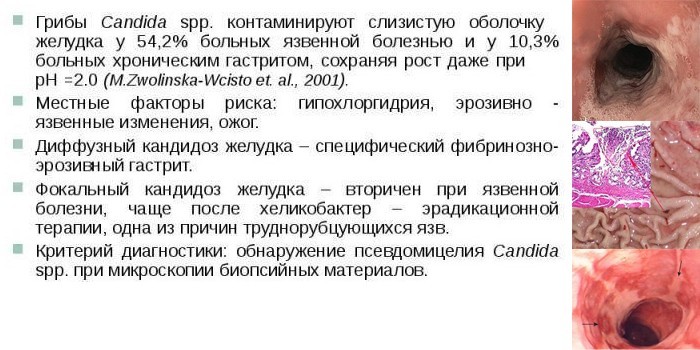 Грибковое поражение желудка