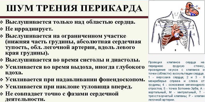 Шум трения перикарда