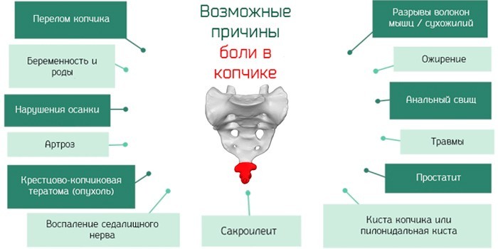 Причины болей в копчике