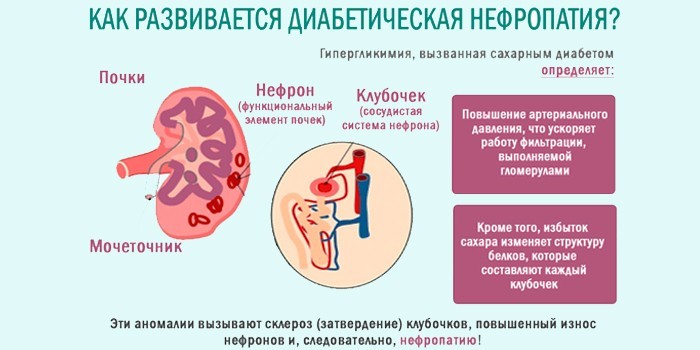 Развития диабетической формы