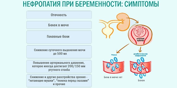 Нефропатия при беременности