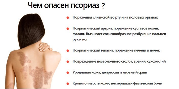 Чем опасен псориаз