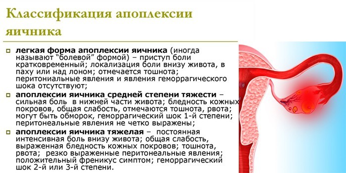 Классификация апоплексии