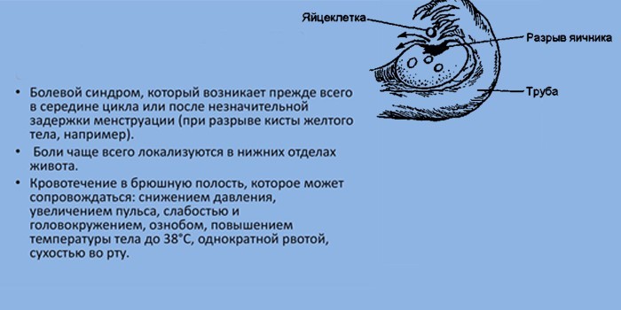 Основные симптомы