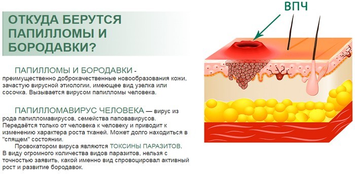 Бородавки и папилломы