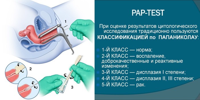 Pap-test