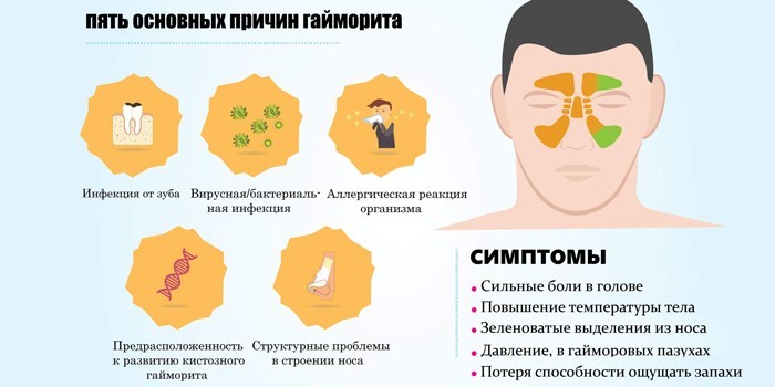 Основные причины гайморита