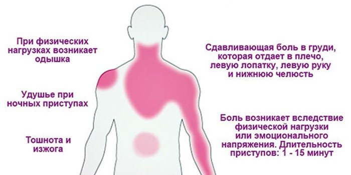Локализация болей и симптоматика