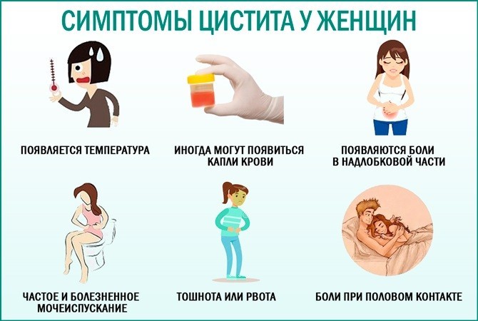 Симптомы цистита у женщин