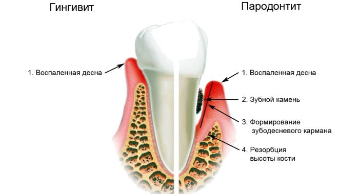Заболевания ротовой полости