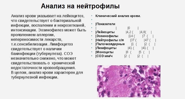 Анализ на нейтрофилы