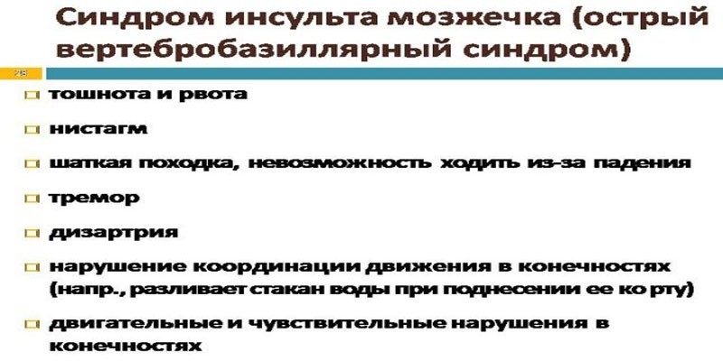 Симптомы инсульта мозжечка