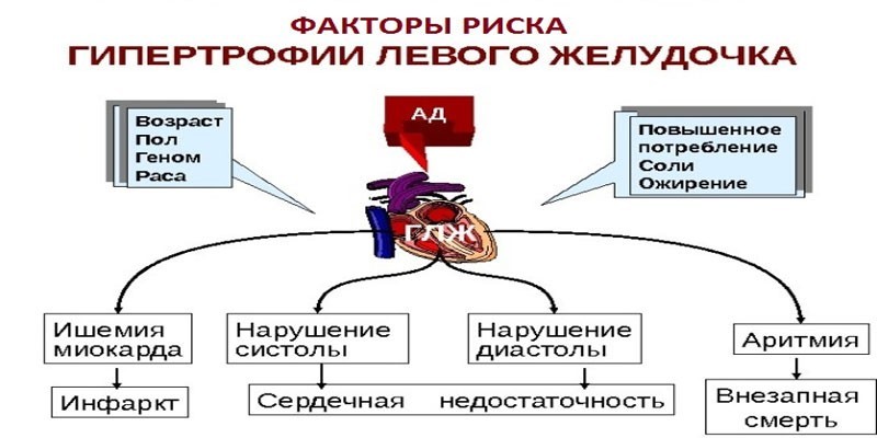 Последствия гипертрофии левого желудочка