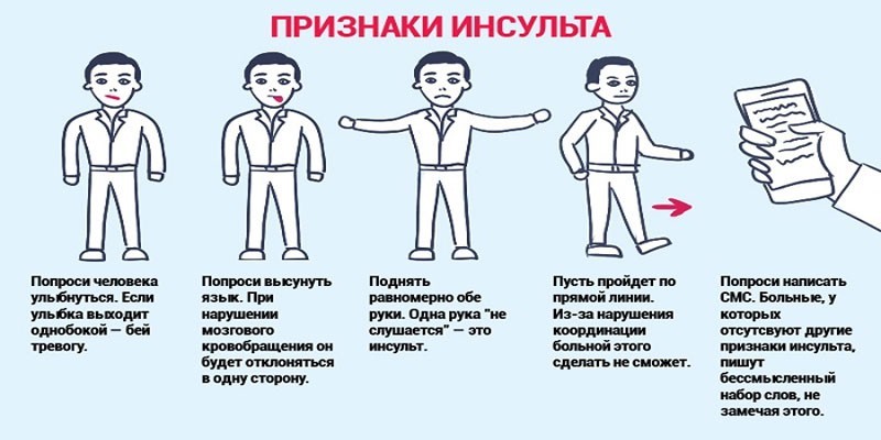 Симптомы инсульта
