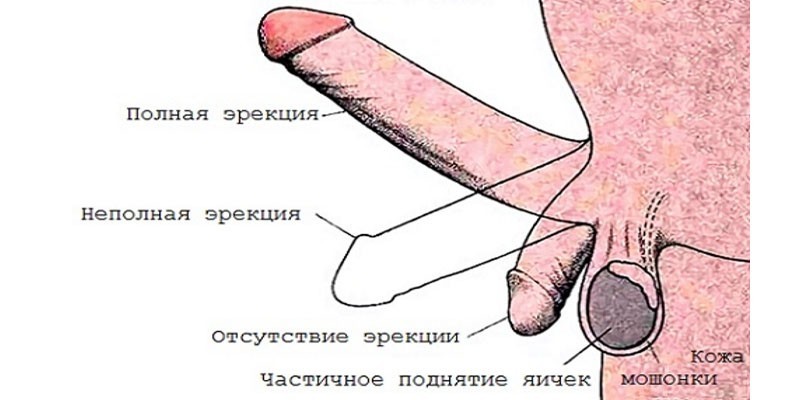 Проявления неполной эрекции