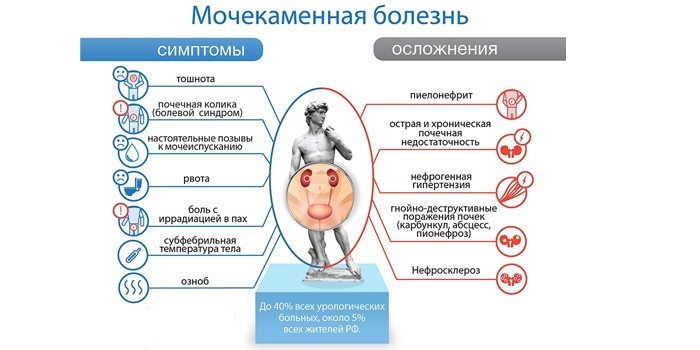 Симптомы и осложнения мочекаменной болезни