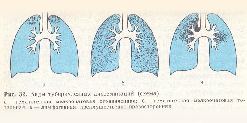 Классификация