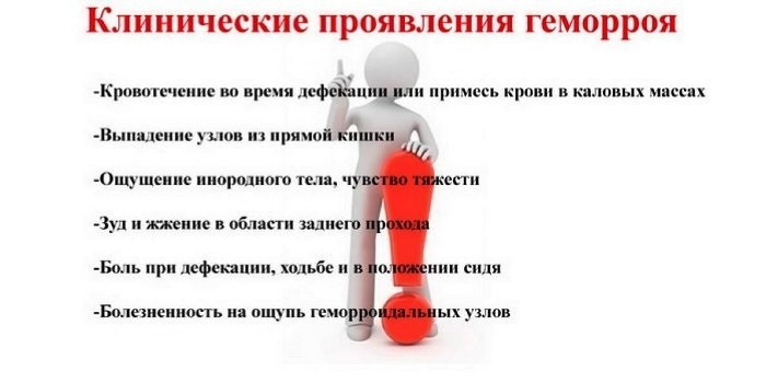 Клинические проявления геморроя