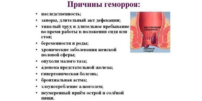 Причины заболевания
